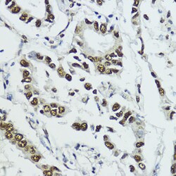 Invitrogen Phospho-Histone H3 (Thr11) Polyclonal Antibody 100 &mu;L; Unconjugated:Antibodies,