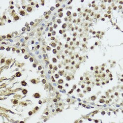 Invitrogen Phospho-Histone H3 (Thr11) Polyclonal Antibody 100 &mu;L; Unconjugated:Antibodies,