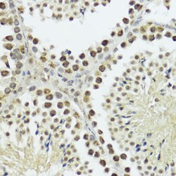 Invitrogen Phospho-Histone H3 (Thr11) Polyclonal Antibody 100 &mu;L; Unconjugated:Antibodies,