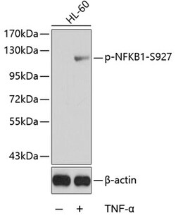 Invitrogen Phospho-NFkB p105 (Ser927) Polyclonal Antibody 100 &mu;L; Unconjugated:Antibodies,