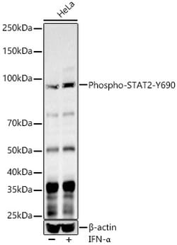 Invitrogen Phospho-STAT2 (Tyr690) Polyclonal Antibody 100 &mu;L; Unconjugated:Antibodies,