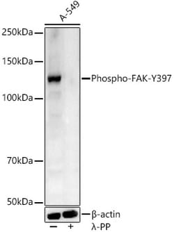 Invitrogen Phospho-FAK (Tyr397) Polyclonal Antibody 100 &mu;L | Buy Online | Invitrogen&trade; | Fisher Scientific