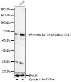 Invitrogen Phospho-NFkB p65 (Ser311) Polyclonal Antibody 100 &mu;L; Unconjugated:Antibodies,