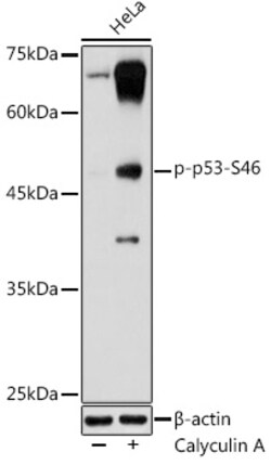 Invitrogen Phospho-p53 (Ser46) Polyclonal Antibody 100 &mu;L; Unconjugated:Antibodies,