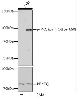 Invitrogen Phospho-PKC Pan (Ser660) Polyclonal Antibody 100 &mu;L; Unconjugated:Antibodies,