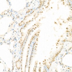 Invitrogen Phospho-c-Raf (Ser338) Polyclonal Antibody 100 &mu;L; Unconjugated:Antibodies,