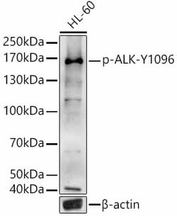 Phospho-ALK (Tyr1096) Polyclonal Antibody:Antibodies, Polyclonal