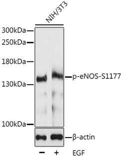 Invitrogen Phospho-eNOS (Ser1177) Polyclonal Antibody 100 &mu;L; Unconjugated:Antibodies,