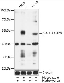 Invitrogen Phospho-Aurora A (Thr288) Polyclonal Antibody 100 &mu;L; Unconjugated:Antibodies,