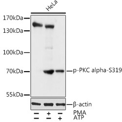 Invitrogen Phospho-PKC alpha (Ser319) Polyclonal Antibody 100 &mu;L; Unconjugated:Antibodies,