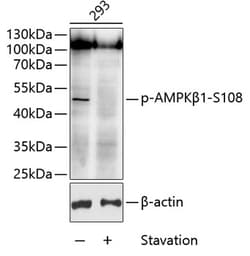 Invitrogen Phospho-AMPK beta-1 (Ser108) Polyclonal Antibody 100 &mu;L;