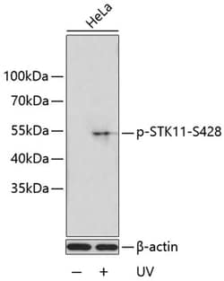 Invitrogen Phospho-LKB1 (Ser428) Polyclonal Antibody 100 &mu;L; Unconjugated:Antibodies,