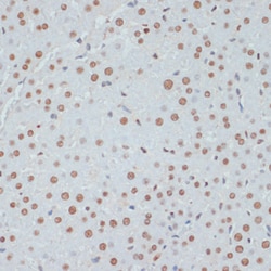 Invitrogen Phospho-p53 (Ser33) Polyclonal Antibody 100 &mu;L | Buy Online | Invitrogen&trade; | Fisher Scientific