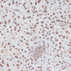 Invitrogen Phospho-p53 (Ser33) Polyclonal Antibody 100 &mu;L | Buy Online | Invitrogen&trade; | Fisher Scientific