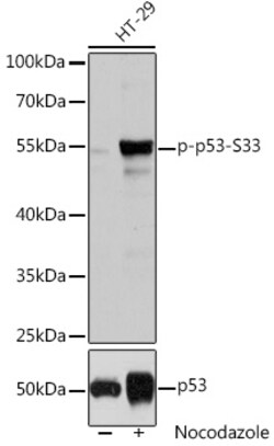 Invitrogen Phospho-p53 (Ser33) Polyclonal Antibody 100 &mu;L | Buy Online | Invitrogen&trade; | Fisher Scientific