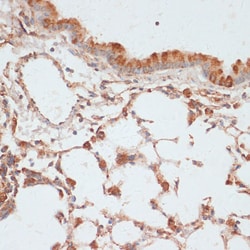 Invitrogen Phospho-VASP (Ser157) Polyclonal Antibody 100 &mu;L; Unconjugated:Antibodies,