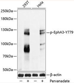 Invitrogen Phospho-Epha3 (Tyr779) Polyclonal Antibody 100 &mu;L; Unconjugated:Antibodies,