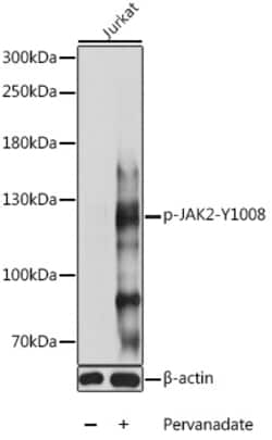Invitrogen Phospho-JAK2 (Tyr1008) Polyclonal Antibody 100 &mu;L; Unconjugated:Antibodies,