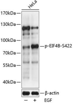 Invitrogen Phospho-eIF4B (Ser422) Polyclonal Antibody 100 &mu;L | Buy Online | Invitrogen&trade; | Fisher Scientific
