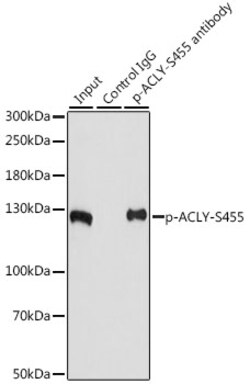 Invitrogen Phospho-ATP Citrate Lyase (Ser455) Polyclonal Antibody 100 &mu;L | Buy Online | Invitrogen&trade; | Fisher Scientific