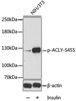 Invitrogen Phospho-ATP Citrate Lyase (Ser455) Polyclonal Antibody 100 &mu;L | Buy Online | Invitrogen&trade; | Fisher Scientific