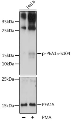Phospho-PEA15 (Ser104) Polyclonal Antibody:Antibodies, Polyclonal
