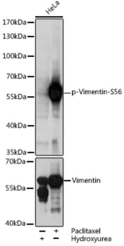 Invitrogen Phospho-Vimentin (Ser56) Polyclonal Antibody 100 &mu;L; Unconjugated:Antibodies,