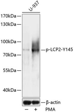 Invitrogen Phospho-SLP76 (Tyr145) Polyclonal Antibody 100 &mu;L | Buy Online | Invitrogen&trade; | Fisher Scientific