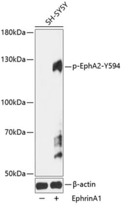 Invitrogen Phospho-EphA2 (Tyr594) Polyclonal Antibody 100 &mu;L | Buy Online | Invitrogen&trade; | Fisher Scientific