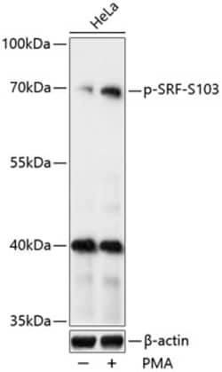 Invitrogen Phospho-SRF (Ser103) Polyclonal Antibody 100 &mu;L; Unconjugated:Antibodies,