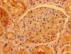 Invitrogen AACS Polyclonal Antibody 100 &mu;g; Unconjugated:Antibodies,