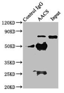 Invitrogen AACS Polyclonal Antibody 100 &mu;g; Unconjugated:Antibodies,