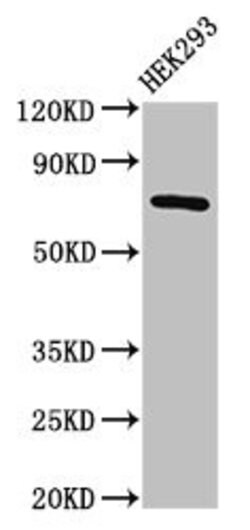 Invitrogen AACS Polyclonal Antibody 100 &mu;g; Unconjugated:Antibodies,
