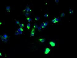 Invitrogen ABHD2 Polyclonal Antibody 100 &mu;g; Unconjugated:Antibodies,