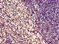 Invitrogen ABHD2 Polyclonal Antibody 100 &mu;g; Unconjugated:Antibodies,