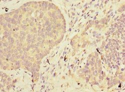 Invitrogen ABHD2 Polyclonal Antibody 100 &mu;g; Unconjugated:Antibodies,