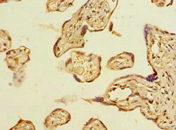 Invitrogen ABHD2 Polyclonal Antibody 100 &mu;g; Unconjugated:Antibodies,