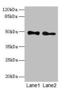 Invitrogen ABHD2 Polyclonal Antibody 100 &mu;g; Unconjugated:Antibodies,