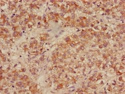 Invitrogen ACADL Polyclonal Antibody 100 &mu;g; Unconjugated:Antibodies,
