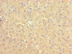 Invitrogen ACADS Polyclonal Antibody 100 &mu;L; Unconjugated:Antibodies,