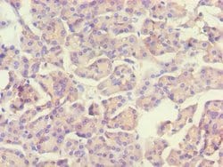 Invitrogen ACADS Polyclonal Antibody 100 &mu;L; Unconjugated:Antibodies,