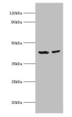 Invitrogen ACADS Polyclonal Antibody 100 &mu;L; Unconjugated:Antibodies,