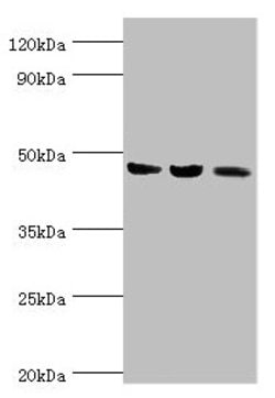 Invitrogen ACAT1 Polyclonal Antibody 100 &mu;L | Buy Online | Invitrogen&trade; | Fisher Scientific