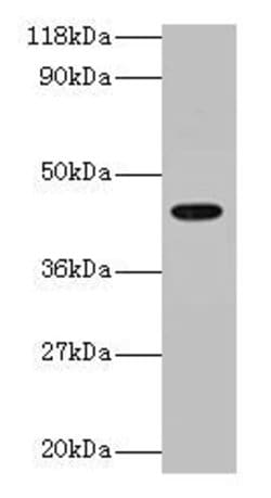 Invitrogen ILF2 Polyclonal Antibody 100 &mu;g; Unconjugated:Anticuerpos