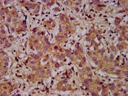 Invitrogen ADAM23 Polyclonal Antibody 100 &mu;g; Unconjugated:Antibodies,