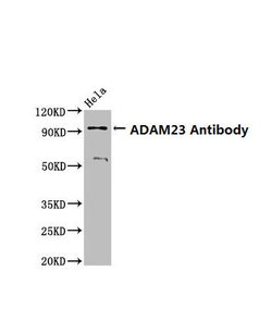 Invitrogen ADAM23 Polyclonal Antibody 100 &mu;g; Unconjugated:Antibodies,