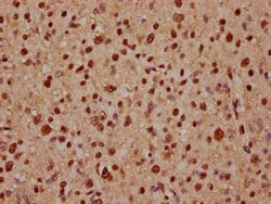 Invitrogen ADAR1 Polyclonal Antibody 100 &mu;L; Unconjugated:Antibodies,