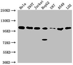 Invitrogen ADAR1 Polyclonal Antibody 100 &mu;L; Unconjugated:Antibodies,
