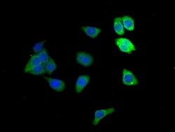 Invitrogen Alcohol Dehydrogenase 1B Polyclonal Antibody 100 &mu;g; Unconjugated:Antibodies,