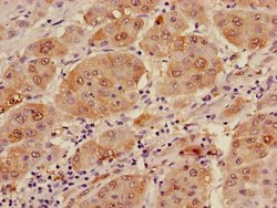 Invitrogen Alcohol Dehydrogenase 1B Polyclonal Antibody 100 &mu;g; Unconjugated:Antibodies,